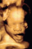 3d-ultraschall-baby-gaehnt